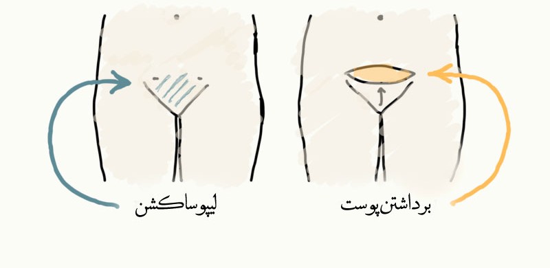 m/مونس پلاستی در تهران