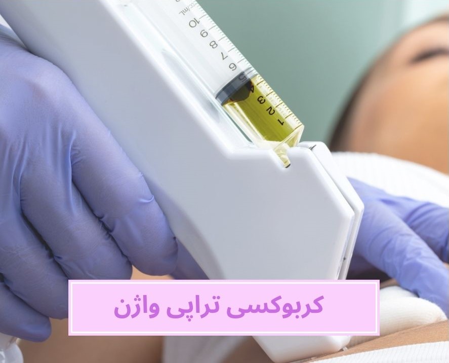m/هزینه کربوکسی تراپی واژن