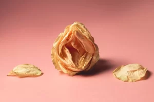 m/لیزر بلیچینگ واژن در تهران
